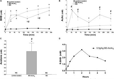 Ketone Administration for Seizure Disorders: History and Rationale for Ketone Esters and Metabolic Alternatives